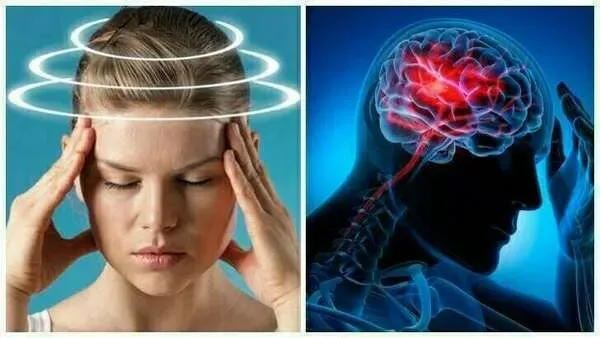 La sophrologie dans la prises en charge des personnes migraineuses